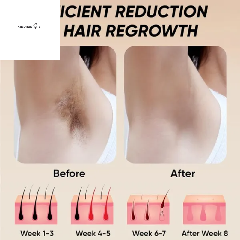 C-Professional IPL Laser Hair Removal Epilator for Body, Bikini & Legs, 900,000 Flashes, 5-Level Adjustable Painless Electric Depilatory Device for Long-Lasting Hair Reduction