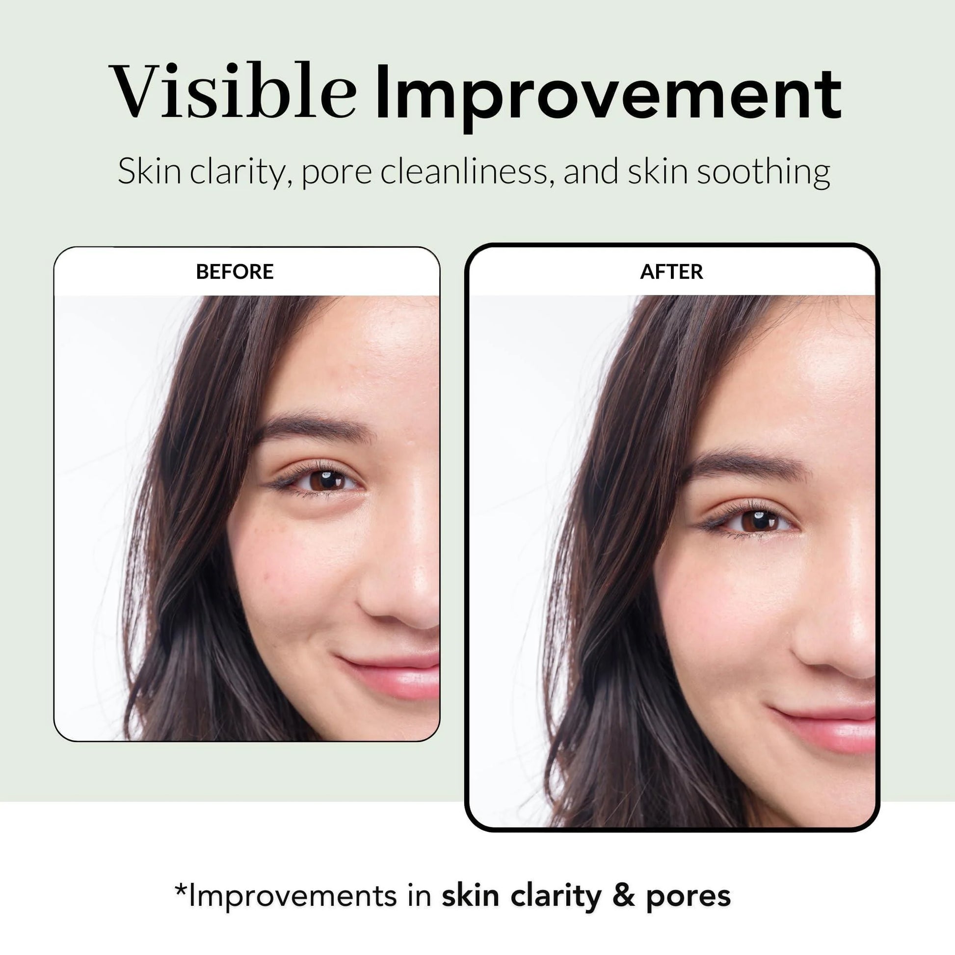 Korean Peel Off Mask - Tea Tree Wrapping Mask Skin Soothing Care Acne Prone Skin 2.4 Oz Teatree & 6 Tropical Fruit Extracts Calming Peel off Mask Korean Skincare for Face