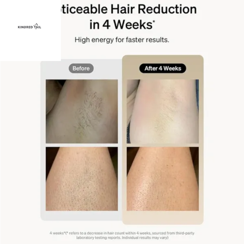 C-Professional IPL Laser Hair Removal Epilator for Body, Bikini & Legs, 900,000 Flashes, 5-Level Adjustable Painless Electric Depilatory Device for Long-Lasting Hair Reduction